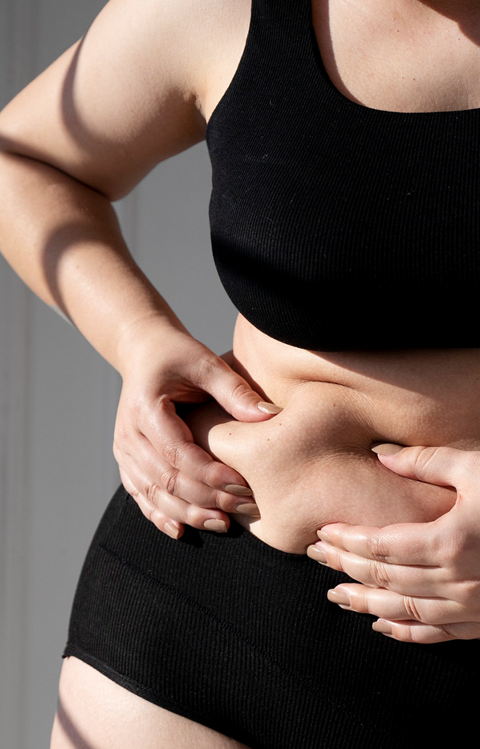 Cirurgia Bariátrica